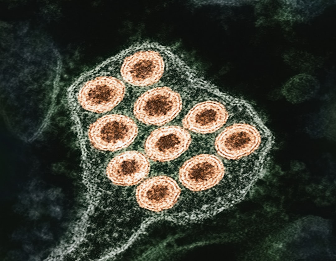 Nature Study Establishes Causal Link Between Epstein-Barr Virus Abundance and Hodgkin's Lymphoma